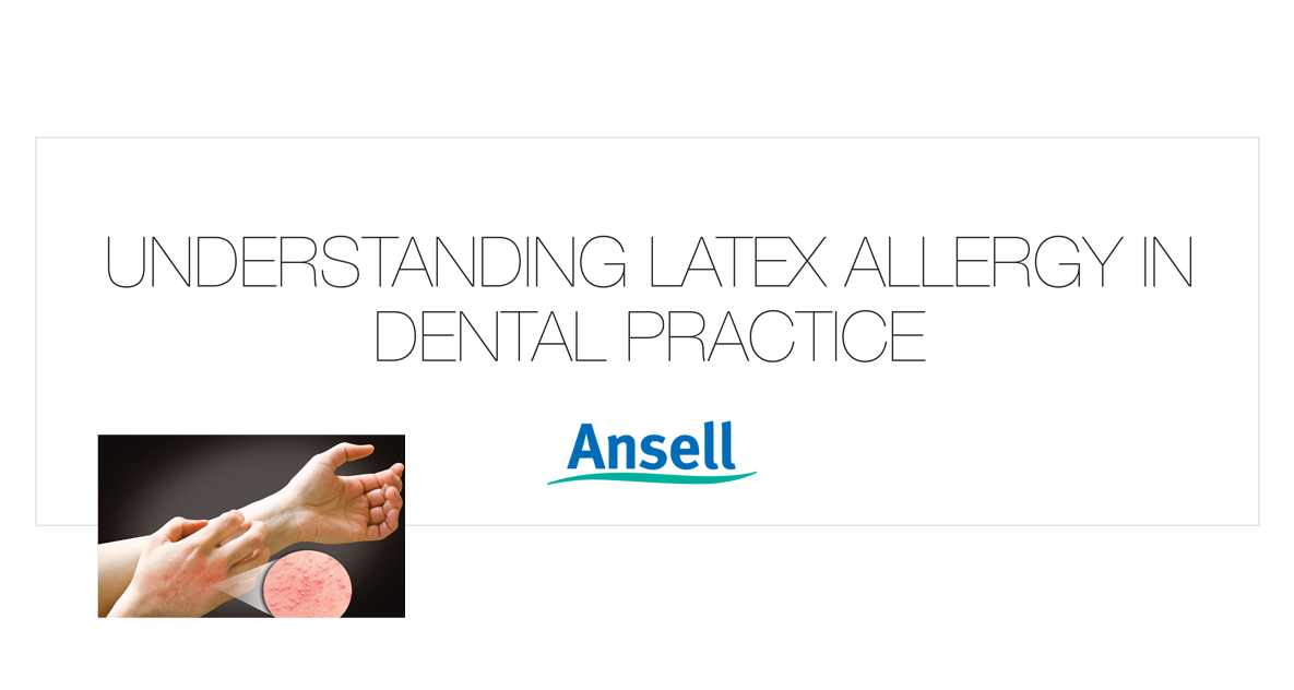 Understanding Latex Allergy In Dental Practice Henry Schein New Zealand